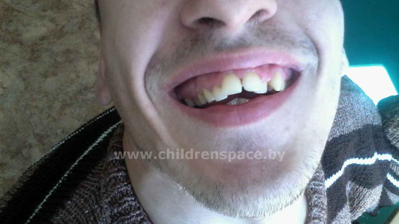 молодой  человек  с  чистыми  зубами